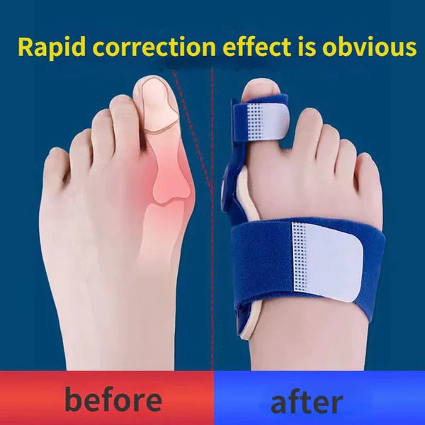 (Bunion) Toe Shaper -50% 0FF