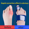 Bunion Toe Shaper -60% 0FF